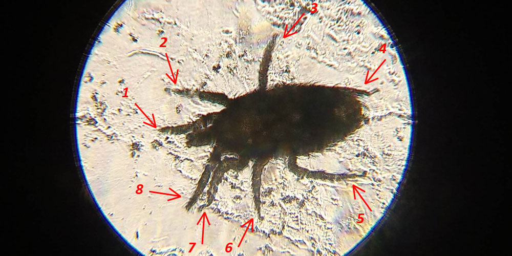 8 legs are most obvious feature that allows you to recognize mites